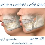 جراحی ارتودنسی دکتر نگار حدادی