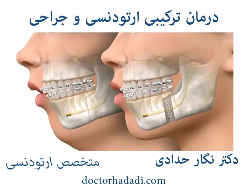 جراحی ارتودنسی دکتر نگار حدادی