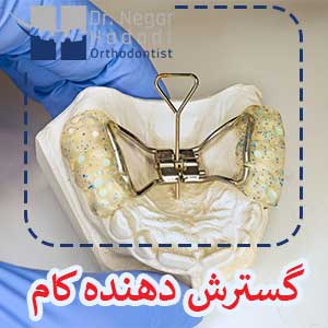 گسترش دهنده کام
