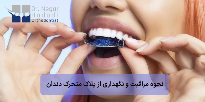 نحوه مراقبت و نگهداری از پلاک متحرک دندان