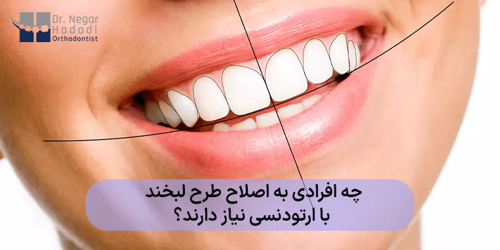 افرادی که به اصلاح طرح لبخند با ارتودنسی نیاز دارند؟