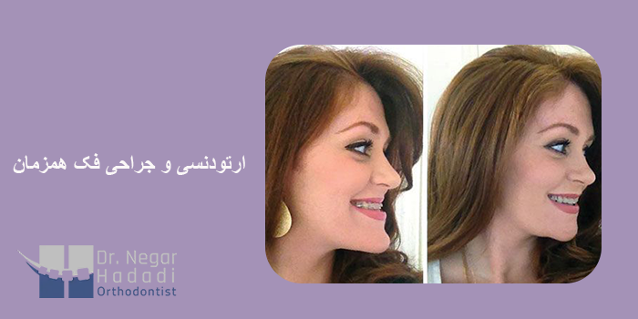 چرا باید از درمان ارتوگناتیک بهره مند شد؟