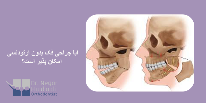 آیا جراحی فک بدون ارتودنسی امکان پذیر است؟