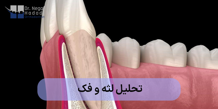 تحلیل لثه و فک