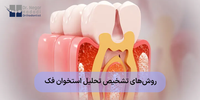 روشهای تشخیص تحلیل استخوان فک
