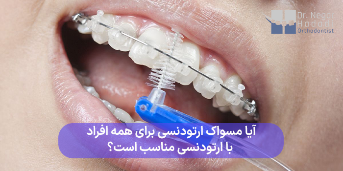 آیا مسواک ارتودنسی برای همه افراد با ارتودنسی مناسب است؟