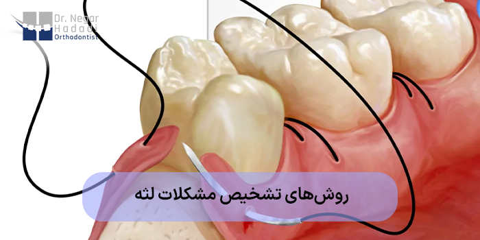 روشهای تشخیص مشکلات لثه