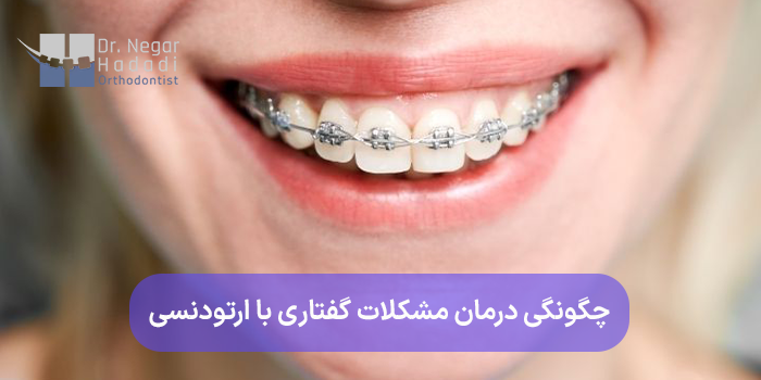 چگونگی درمان مشکلات گفتاری با ارتودنسی