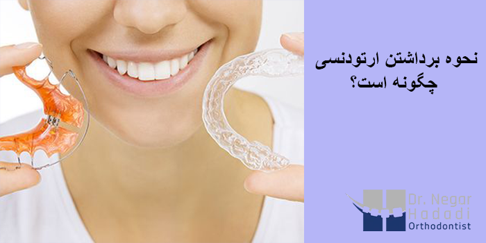 نحوه برداشتن ارتودنسی چگونه است؟