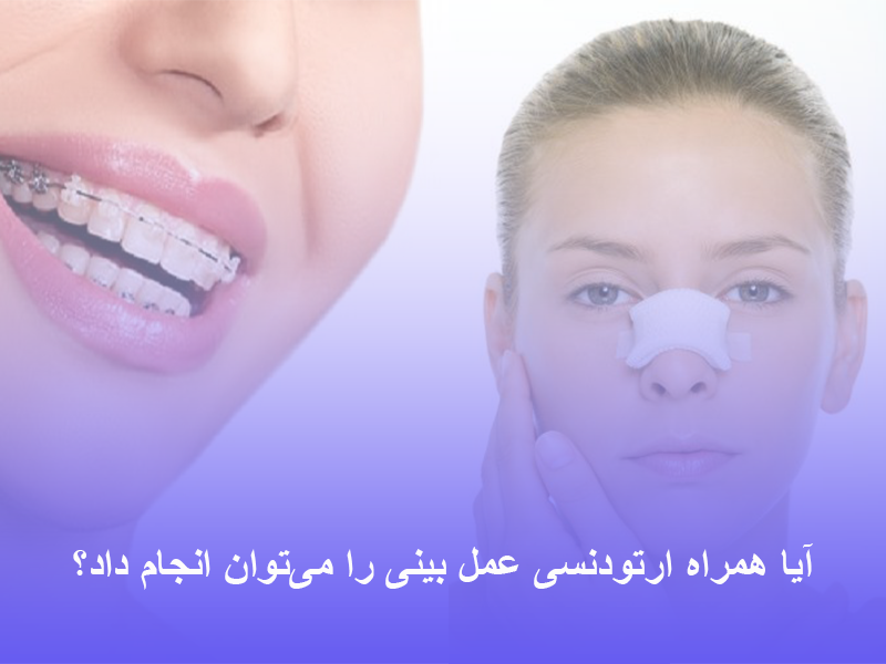 ارتودنسی با عمل بینی