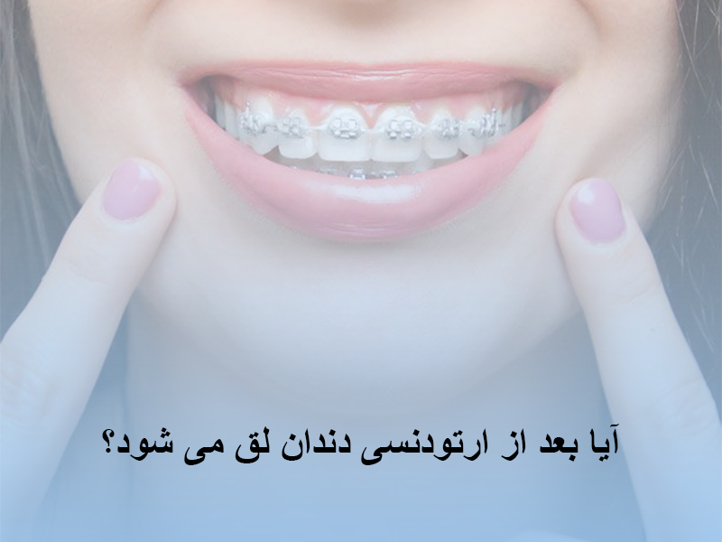 لق شدن دندان بعد از ارتودنسی
