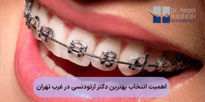 اهمیت انتخاب بهترین دکتر ارتودنسی در غرب تهران