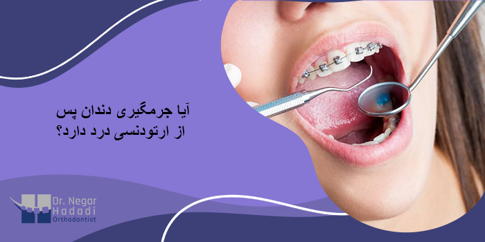 آیا جرمگیری دندان پس از ارتودنسی درد دارد؟