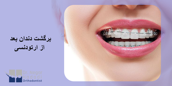 برگشت دندان بعد از ارتودنسی