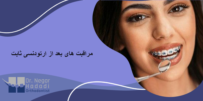 مراقبت های بعد از ارتودنسی ثابت