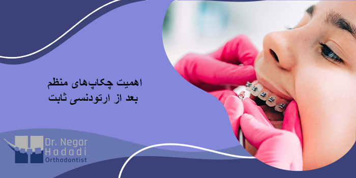 اهمیت چکاپهای منظم بعد از ارتودنسی ثابت