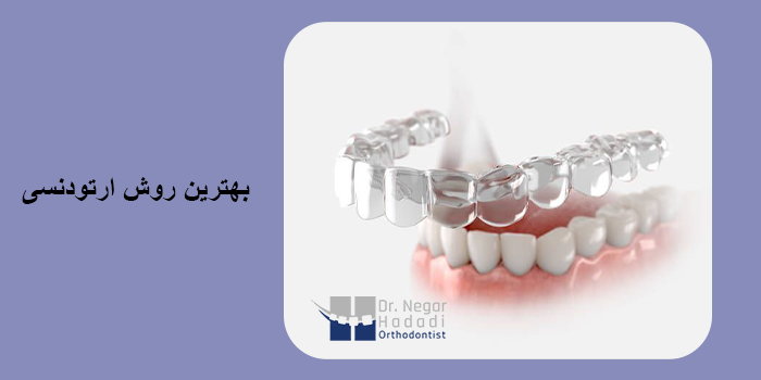 بهترین روش ارتودنسی
