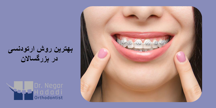 بهترین روش ارتودنسی در بزرگسالان