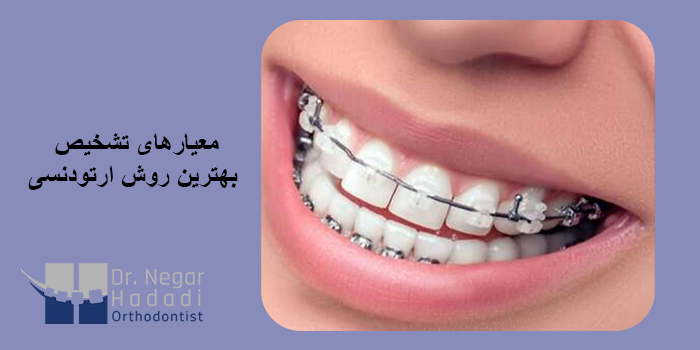 معیارهای تشخیص بهترین روش ارتودنسی