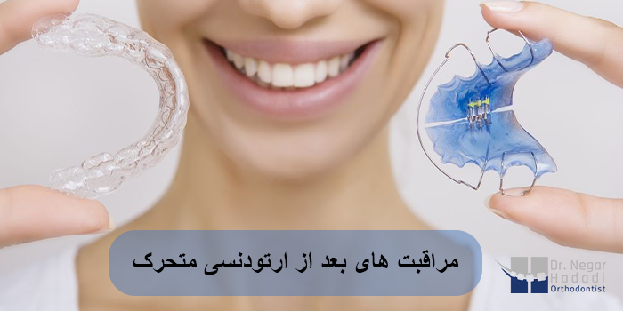 مراقبت های بعد از ارتودنسی متحرک