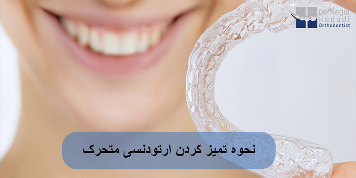 چه غذاهایی بعد از ارتودنسی متحرک نباید بخوریم؟