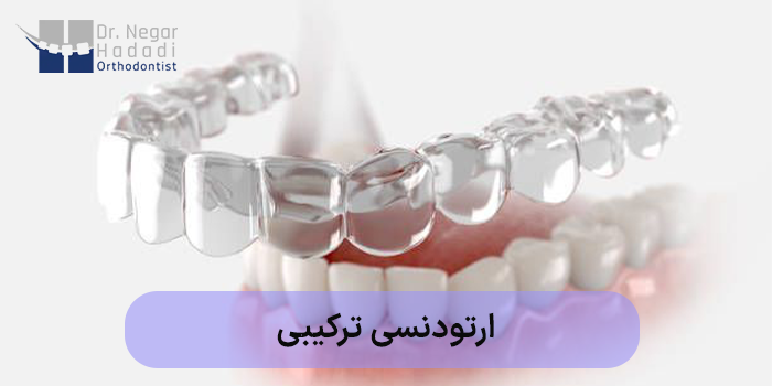 ارتودنسی ترکیبی