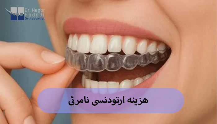 هزینه ارتودنسی نامرئی