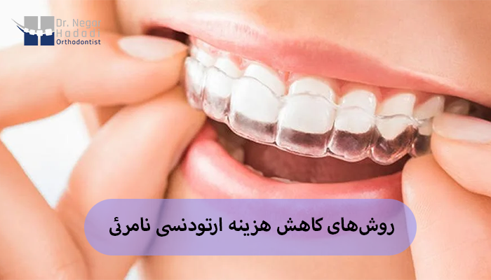 روشهای کاهش هزینه ارتودنسی نامرئی
