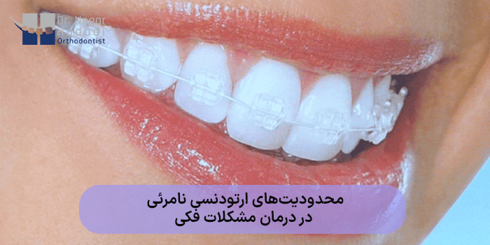 محدودیتهای ارتودنسی نامرئی در درمان مشکلات فکی