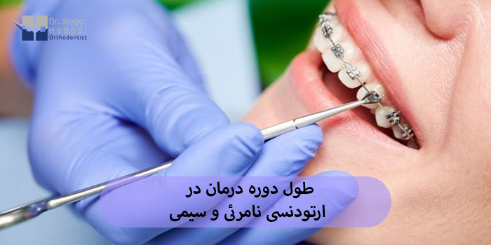 طول دوره درمان در ارتودنسی نامرئی و سیمی